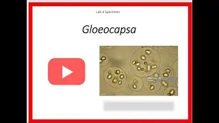Gloecapsa