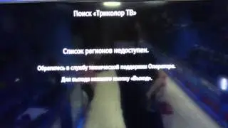 GS U210CI B (пациент 2) нет сигнала, список каналов недоступен.