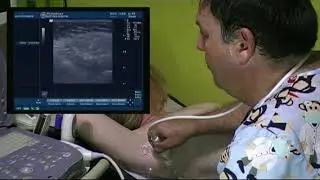 AXILLA ULTRASOUND TECHNIQUE