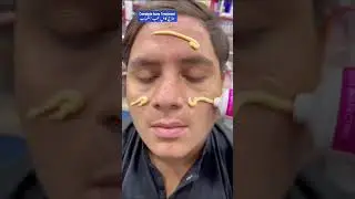 Best Acne Cleanser. ایکنی پیمپل دانوں کا مکمل خاتمہ 