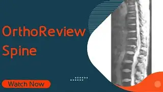 OrthoReview - Spine