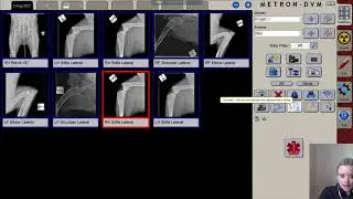 ClaroX DR System Software: Database, Search Function and Export - video 6