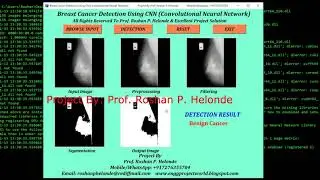 Python Code for Breast Cancer Detection Using CNN | IEEE Based Project #PythonSourceCode