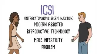 ICSI - Intracytoplasmic Sperm Injection in Los Angeles and Orange County