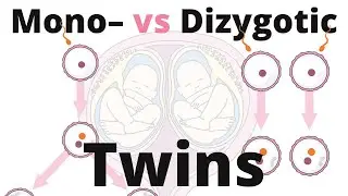 Difference between Monozygotic and Dizygotic Twins
