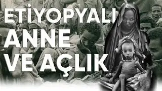 Etiyopya'da Kıtlık  /  Pulitzer Ödüllü Karenin Hikayesi