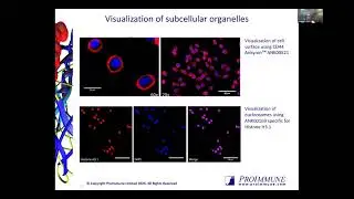 Charlotte Thompson: Ankyrons: The future of target-binding reagents beyond antibodies