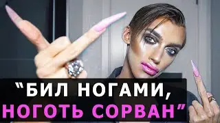 Андрея Петрова избили. Бьюти-блогер Андрей Петров рассказал о драке и назвал причину.