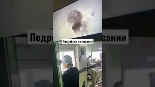 Пункция ооцитов (яйцеклеток) как выглядит