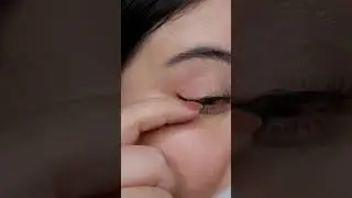 Hack párpado caído ¿funciona?