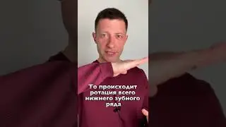 Попытка корпусной дистализации нижнего зубного ряда нижних моляров / Ортодонт Эксперт