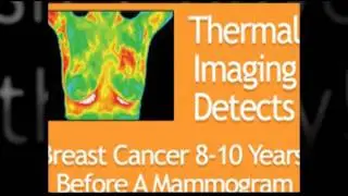 Breast Cancer Early Detection