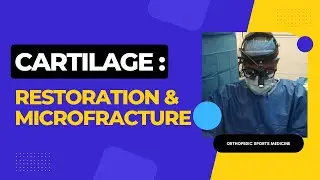Cartilage Restoration and Microfracture in 2023