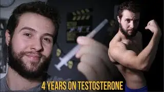 FtM Transition - 4 Years On Testosterone