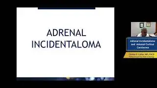 Adrenal Incidentaloma and Adrenal Cortical Carcinoma