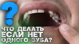 Что делать, если нет одного зуба?