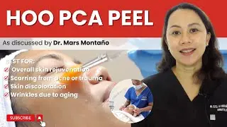 PCA SKIN PEEL