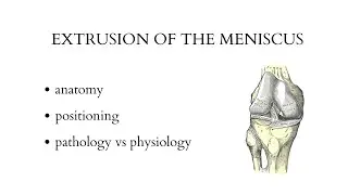 EXTRUSION OF THE MENISCUS - musculoskeletal ultrasound examination