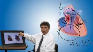 Pediatric Playbook: Congenital Heart Defect Hypoplastic Left Heart Syndrome (HLHS)