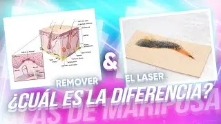 ¿Láser o removedor? ¿Qué elegir? Eliminación de micropigmentación con láser.