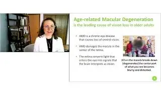 Age Related Macular Degeneration: Risk Reduction and Improved Treatment Outcomes
