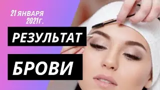 ОЖОГ БРОВЕЙ ЧТО ДЕЛАТЬ?