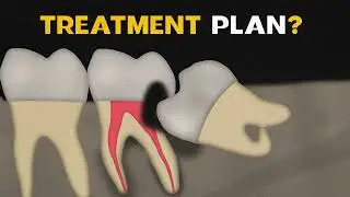 TREATMENT PLANNING