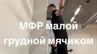 МФР малой грудной мышцы мячиком