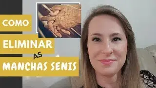 Como ELIMINAR as MANCHAS SENIS ? - Dra Cínthia Orasmo Dermatologista