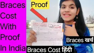 Braces cost in India with proof  Mere braces Ka kharcha Kitna hua A To Z Jankari braces ki cost ki