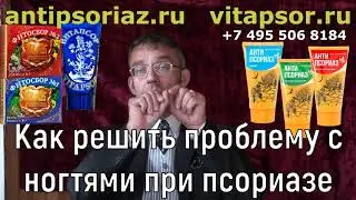 Как решить проблему с ногтями при псориазе