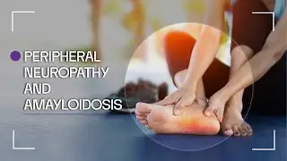 Let you Know about Peripheral Neuropathy and Amyloidosis. #varcolegcare