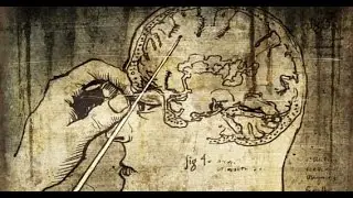 10 Most Horrifying Ancient Medical Treatments Which Fortunately Are Not Practiced Now