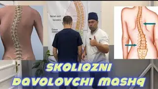 Skoliozni davolash mashqi.