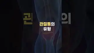 관절통 생기는 의외의 이유❓#관절통증 #댓글참고 #한약사 #건강정보