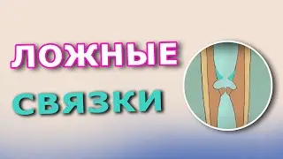 Ложные связки
