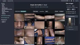 Filter Images
