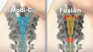 Mobi-C vs Fusion Animation Video