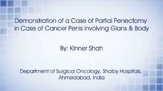 - Demonstration of a Case of Partial Penectomy in Case of Cancer Penis involving Glans & Body