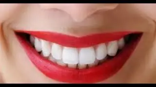 ОТБЕЛИВАНИЕ ЗУБОВ НАТУРАЛЬНЫМИ СРЕДСТВАМИ