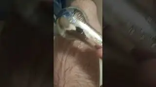 Leg
