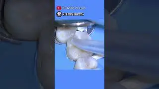 AMAZING Restoration of A Restoration 