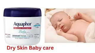 Dry skin care for baby/  Dry Skin /baby loson