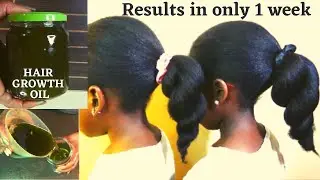 Visible Results in just 1 week. Do not Wash it Out, Use this Oil 2 Regrow bald spot & alopecia fast.