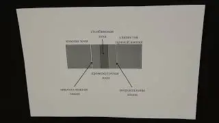 Прямая кишка и анус
