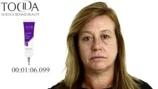 שקיות מתחת לעיניים? עיניים עייפות? כהויות סביב העיניים? קמטים וקמטוטים?