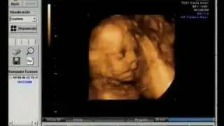 Leon Lianes Casado Highlights