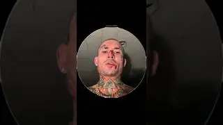 ⚡ MORGENSHTERN ПОЛУЧИЛ ТРАВМУ ВО ВРЕМЯ СЪЁМКИ КЛИПА!!!