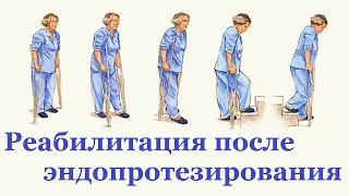 Реабилитация после эндопротезирования
