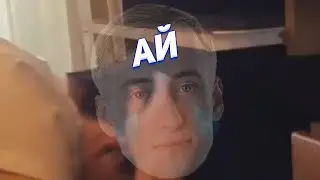 АЙ БОЛЬНО В РУКЕ